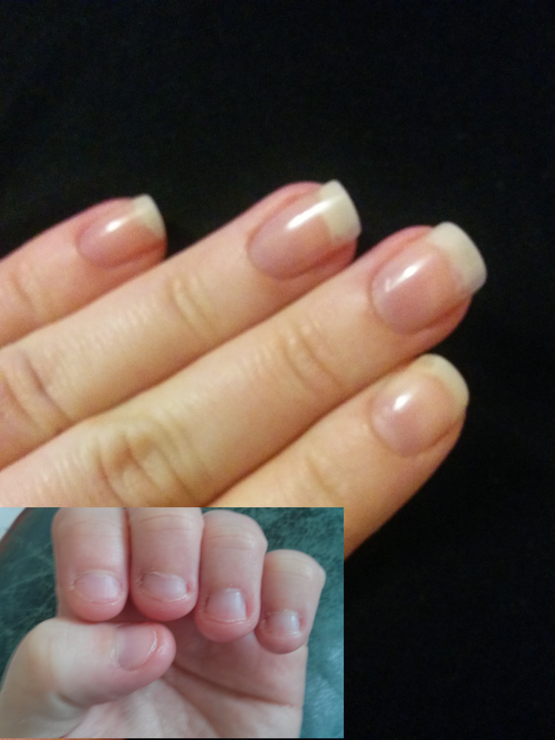 Huile De Ricin Ongles Avant Apres